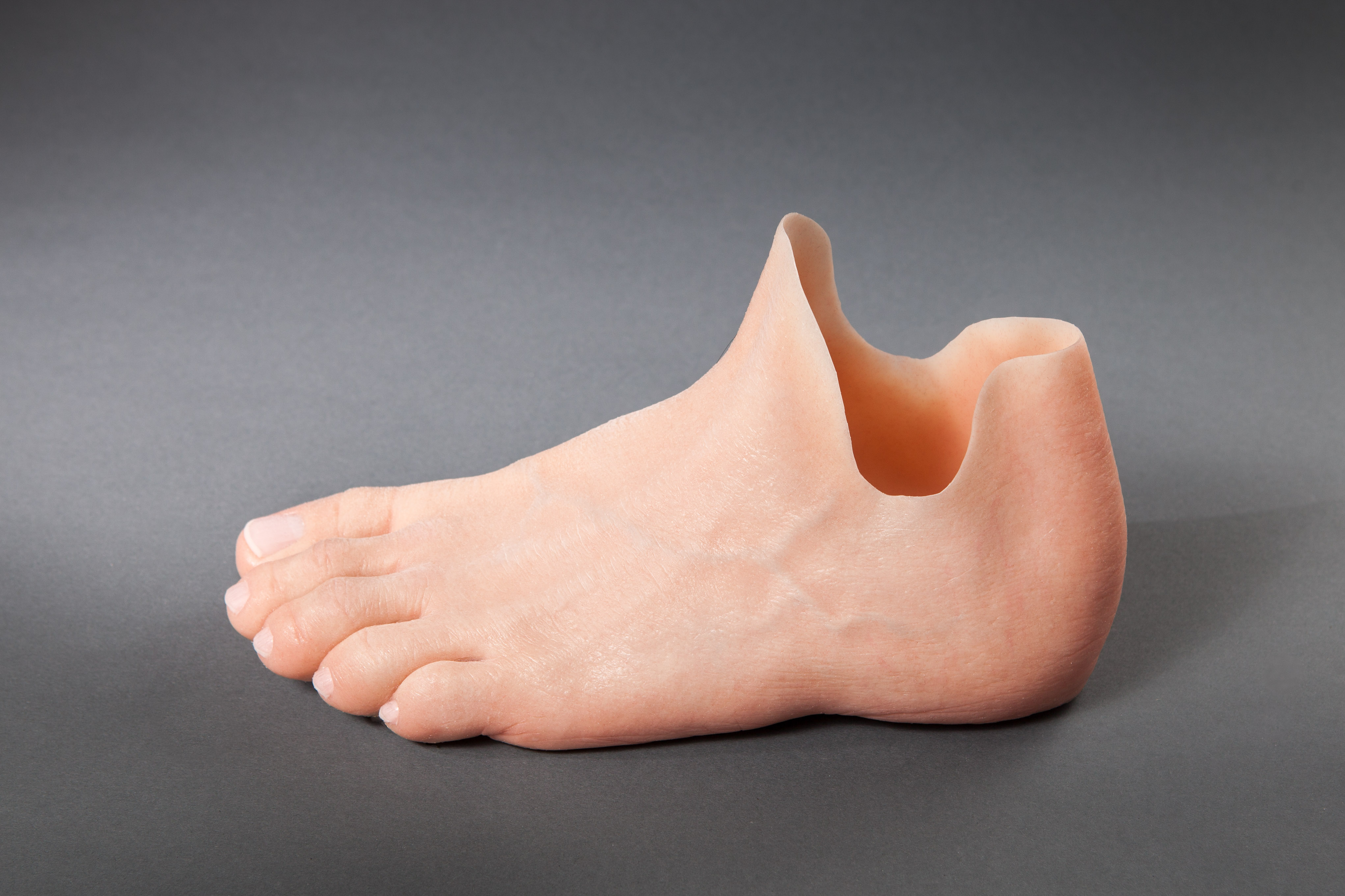 German StartUp teases Silicone prosthesis out of 3D Printers
