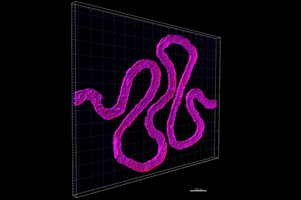 Using fugitive ink, a convoluted hollow channel is fabricated to mimic the winding shape of natural proximal tubules found inside a human kidney's nephrons. Image: Lewis Lab/Wyss Institute at Harvard University.