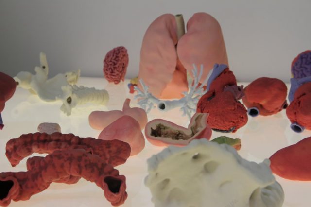 3dyourscan_whiteclouds_3d_printing_anatomical_models_surgeons3