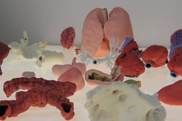3DyourSCAN Service by WhiteClouds Provides with 3D Anatomical Models