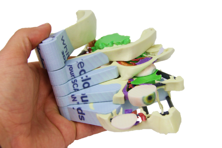 3dyourscan_whiteclouds_3d_printing_anatomical_models_surgeons4