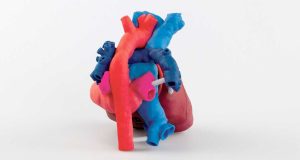 This 3D printed, patient-specific heart model helps surgeons view the patient’s anatomy in 3D, prior to surgery.