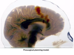 OpenVCAD: Open-Source Software Simplifies Design Processes for Multi-Material 3D Printing