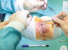 3D-printed eye models: Innsbruck team trains eyelid surgery with Stratasys system